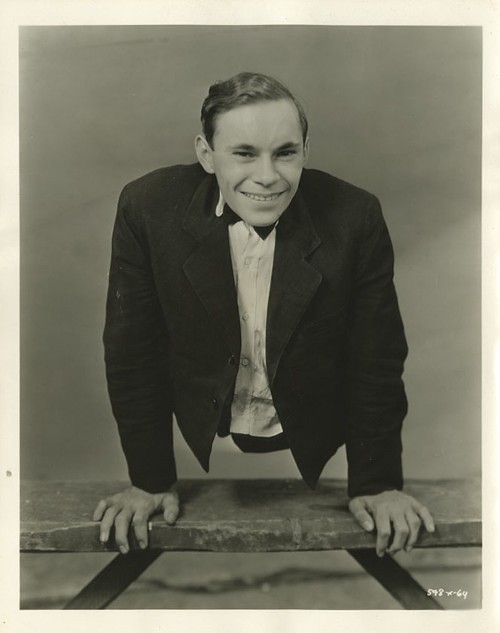 Johnny Eck was born with no lower body.He lived to be 80 years old.