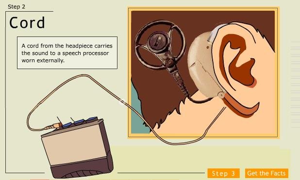 To do that, we implant electrodes into the cochlea ! This is called a COCHLEAR IMPLANT. Instead of the ear, we can attach a microphone behind it and send the sounds to a small computer. This analyses the sound and figures out the electrical pulses that...