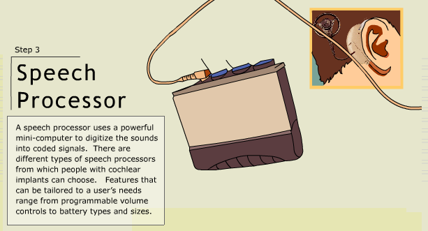 To do that, we implant electrodes into the cochlea ! This is called a COCHLEAR IMPLANT. Instead of the ear, we can attach a microphone behind it and send the sounds to a small computer. This analyses the sound and figures out the electrical pulses that...