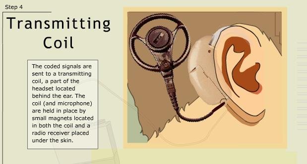 ...must be transmitted to the nerve fibers . How? By taking a Fourier transform! This signal is then given to a transmitting coil, also attached to a person's head along with the microphone. This whole thing is kept in place by magnets! The coil then...