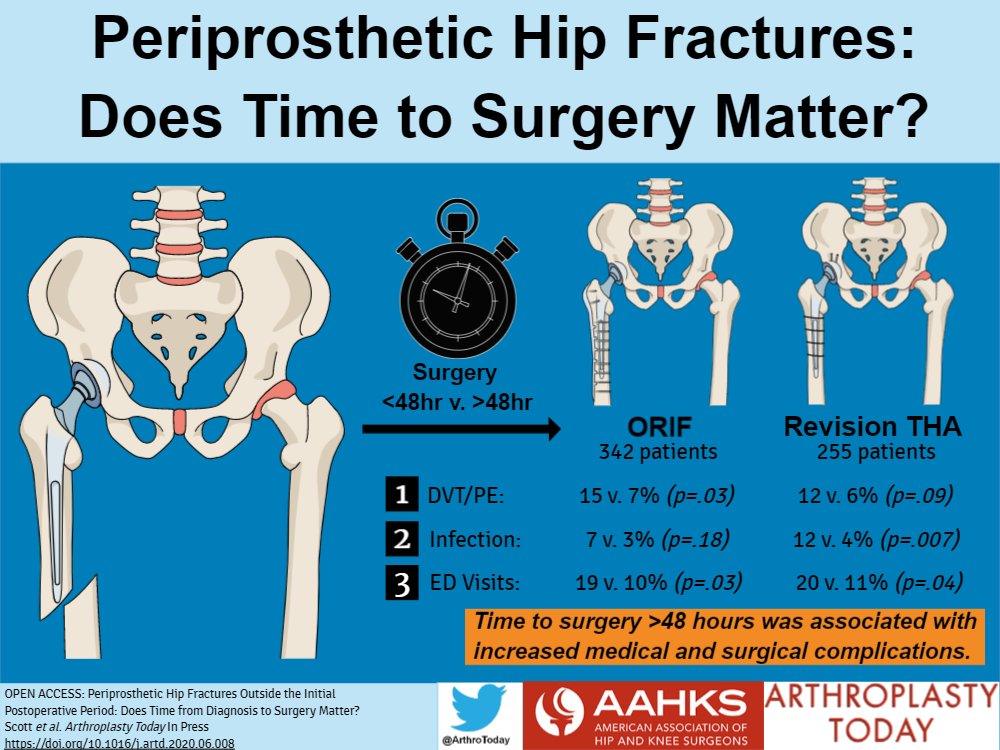 Arthroplasty Today (@arthrotoday) on Twitter photo Surgery >48hr after periprosthetic hip fracture had increased medical and surgical complications. <a href="/AAHKS/">AAHKS</a> <a href="/womenAAHKS/">WomenInArthroplasty</a> @hssarjr 
ow.ly/gxiU50B0qWW Surgery >48hr after periprosthetic hip fracture had increased medical and surgical complications. <a href="/AAHKS/">AAHKS</a> <a href="/womenAAHKS/">WomenInArthroplasty</a> @hssarjr 
ow.ly/gxiU50B0qWW