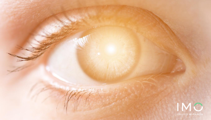 imogrupomiranza's tweet photo. ☀ ¿Proteges tus ojos del sol? Como especialistas en #SaludOcular, te animamos a leer nuestros consejos y adoptar un rol preventivo estas vacaciones. ¡Feliz verano! ➞https://t.co/3yGlRdPDKQ #IMOTeCuida https://t.co/bnWW8qdaSG