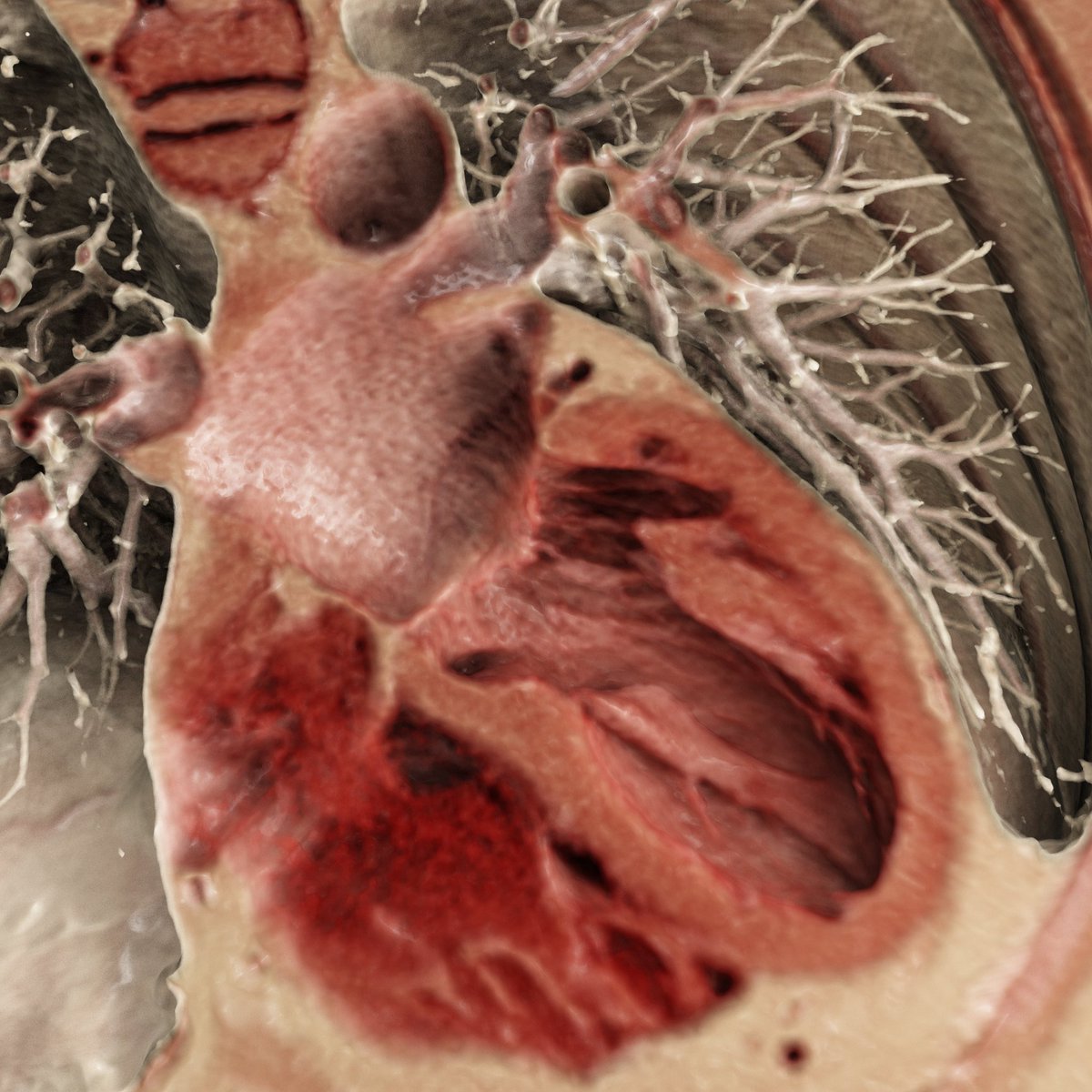 They have a branching pattern that resembles other "fractal" patterns in nature and this self-similarity allows their complexity to be measured. 3/8