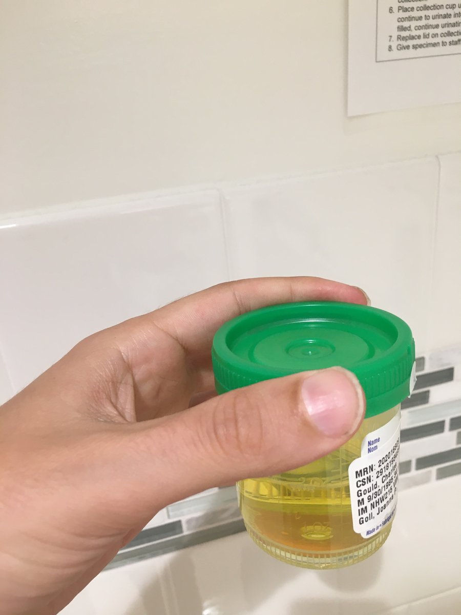 Welp, it’s official! I have a UTI.