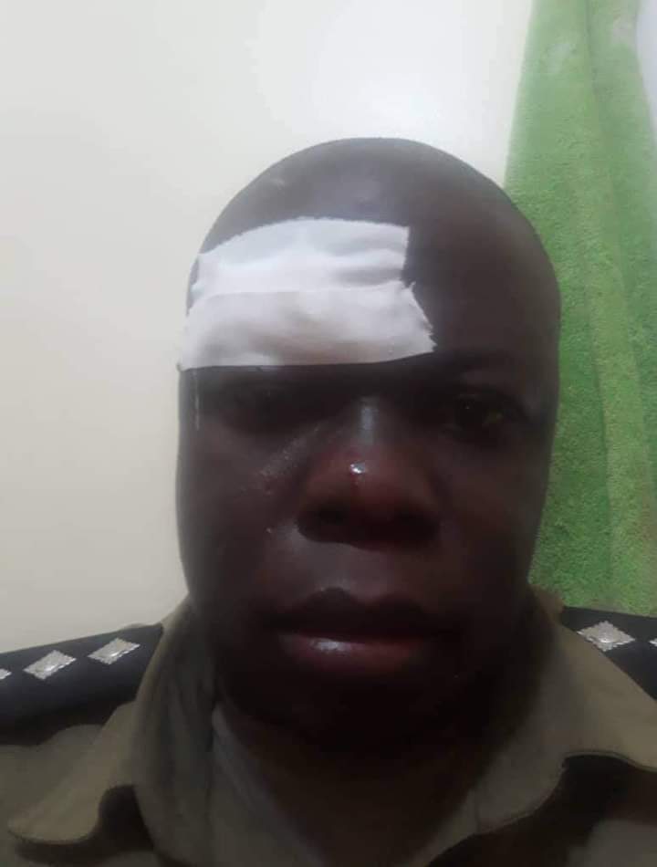 FredNshemereirw's tweet photo. Sorry ASP Kitaka oc operations Kawempe police station has been  attacked and  punched by people power supporters @PoliceUg @AKasingye @mkainerugaba @mucunguzi_jeff @ArthurMirama @OkothOchola1 @ssebunyashaf @JoelSsenyonyi @KagutaMuseveni 
PLEASE NUP stop attacking police 🙏🙏 https://t.co/lWi6W1UIEk