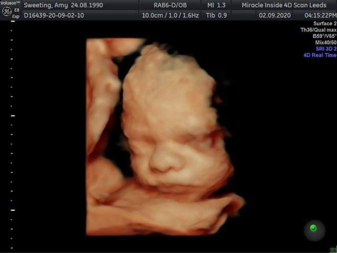 amysweeting's tweet photo. Our baby boy 💙 is it November yet? Me, your daddy and your brother can’t wait to meet you! @mrdeanking https://t.co/z899e3uDYQ