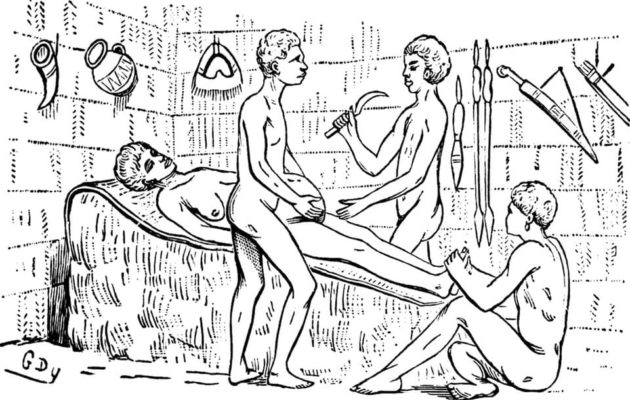 Caesarean Sections Were Performed In Africa Long Before They Were Standardized Across The World. C-sections were invented in Africa long before Europe, and the rest of the world fully mastered how to conduct them. The procedure is said to have been started since time immemorial.