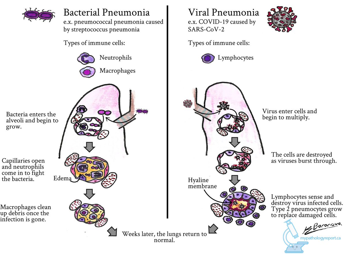 98) It’s also the CDC’s inability to explain how the majority of deaths resulted from bacterial pneumonia. The fact that most of the deaths were caused by bacterial pneumonia seems to correlate with the widely held opinion in 1918 that bacteria was the causal agent of influenza.