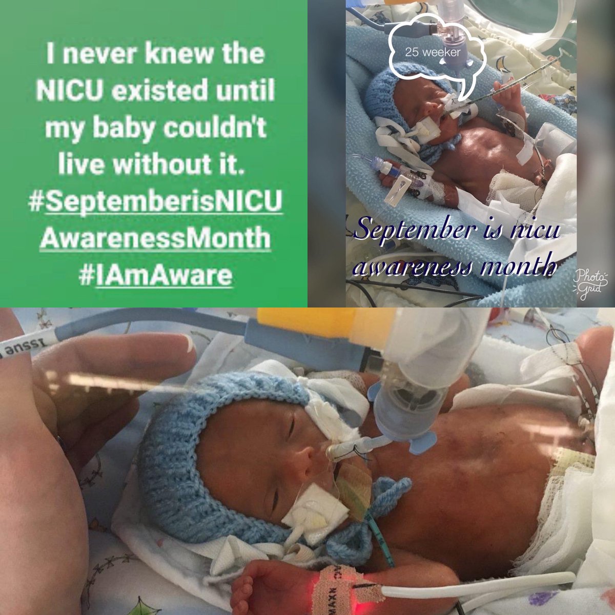 toni29317455's tweet photo. September is NICU awareness month.
#iamaware #nicu @edinsickkids #neonate #25weeker #2lb @Blisscharity @SSCBcharity #5monthsinNICU https://t.co/1eO3et2pmO