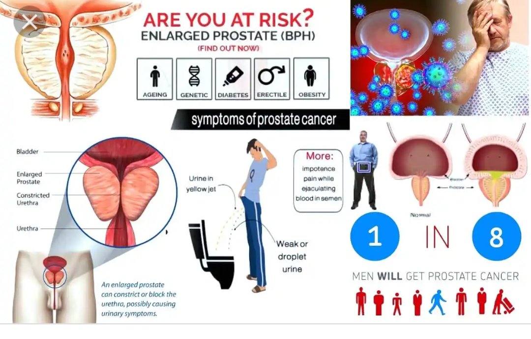 Was hilft bei prostatitis