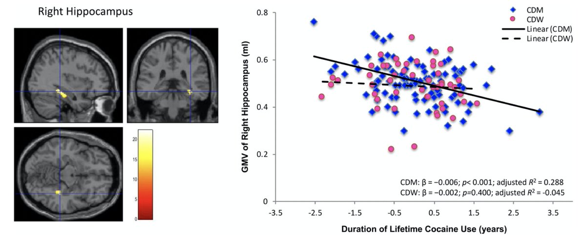 Friedman Brain Institute (@sinaibrain) on Twitter photo CHECK OUT <a href="/bic_ismms/">NARC</a>'s newest manuscript by <a href="/racharabin/">Rachel Rabin</a> et al. on "Common and gender‐specific associations w/ #cocaine use on #graymatter volume: Data from the ENIGMA #addiction working group"! onlinelibrary.wiley.com/doi/full/10.10… <a href="/MountSinaiPsych/">Mount Sinai Psychiatry</a> <a href="/IcahnMountSinai/">Icahn School of Medicine at Mount Sinai</a> <a href="/DouglasResearch/">Douglas Research Centre</a> <a href="/McGillMed/">McGill Medicine and Health Sciences</a> CHECK OUT <a href="/bic_ismms/">NARC</a>'s newest manuscript by <a href="/racharabin/">Rachel Rabin</a> et al. on "Common and gender‐specific associations w/ #cocaine use on #graymatter volume: Data from the ENIGMA #addiction working group"! onlinelibrary.wiley.com/doi/full/10.10… <a href="/MountSinaiPsych/">Mount Sinai Psychiatry</a> <a href="/IcahnMountSinai/">Icahn School of Medicine at Mount Sinai</a> <a href="/DouglasResearch/">Douglas Research Centre</a> <a href="/McGillMed/">McGill Medicine and Health Sciences</a>
