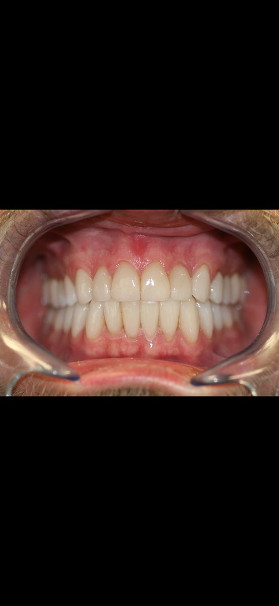 Cosmetic & Implant Dentistry of Naples (naplesdentistry) Twitter