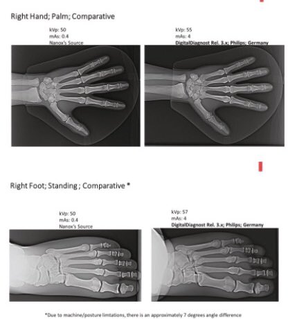 It shows:Traditional Machines: Millions of dollars & 150k per frequent X-ray tube replacement $NNOX will sell its machines using its tube IP for 8k-12k Looks to me like the  $NNOX imaging is slightly better as well far cheaper.