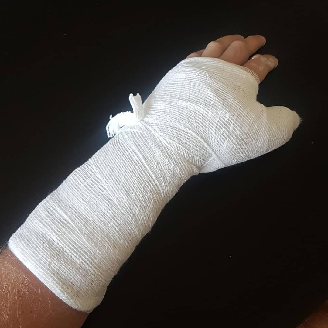 British Endurance Racing Team (@racingbritish) on Twitter photo Weekend warrior! <a href="/boothyeight/">mike booth</a> 💪😬 A post race x-ray has confirmed that Mike Booth rode the majority of the 24 hour race with a broken ulna and scaphoid! An amazing achievement and example of endurance spirit 👏 Weekend warrior! <a href="/boothyeight/">mike booth</a> 💪😬 A post race x-ray has confirmed that Mike Booth rode the majority of the 24 hour race with a broken ulna and scaphoid! An amazing achievement and example of endurance spirit 👏