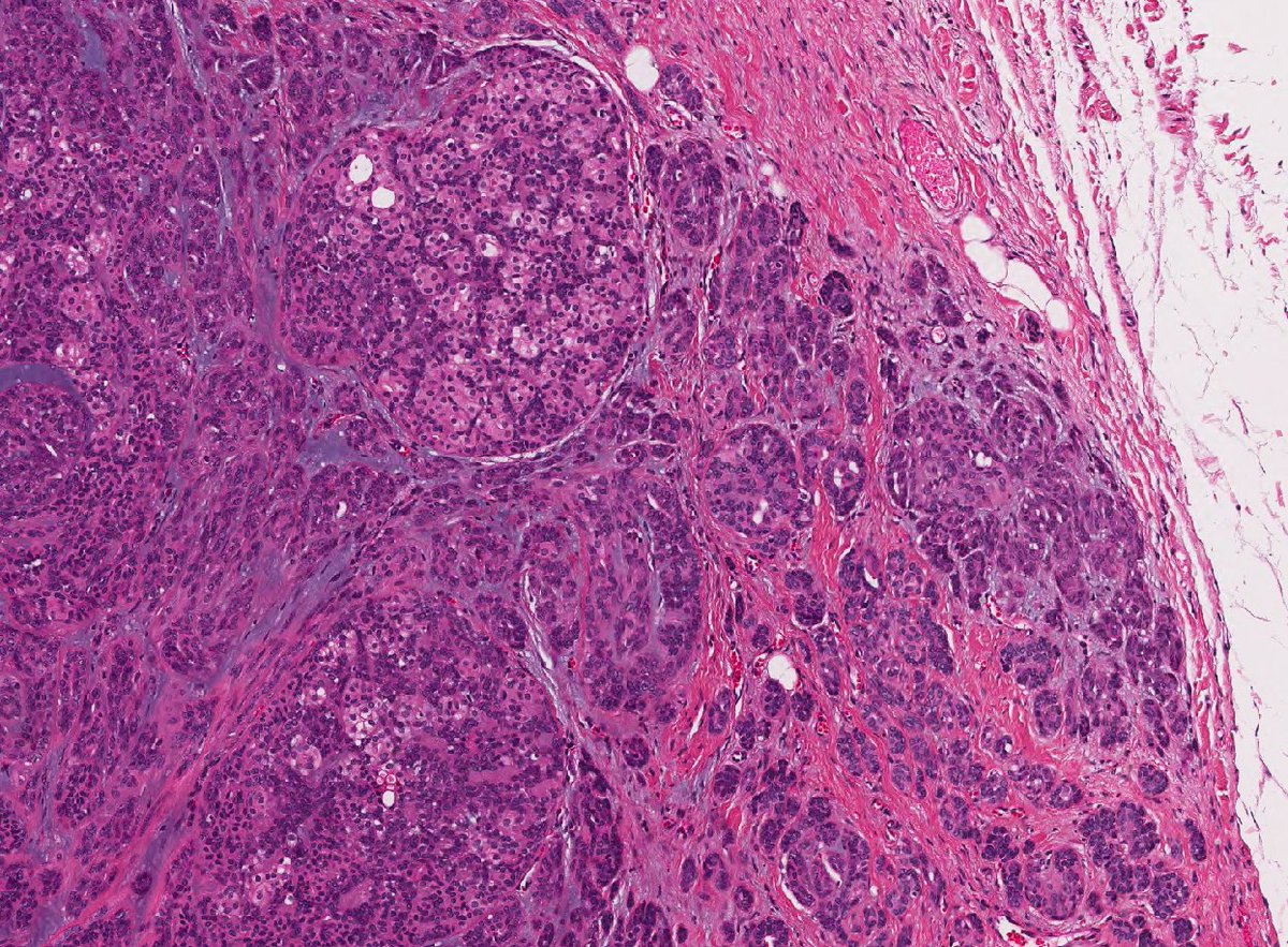 Question 2: Lip mass