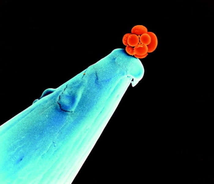 it is an early embryo at the tip of a needle