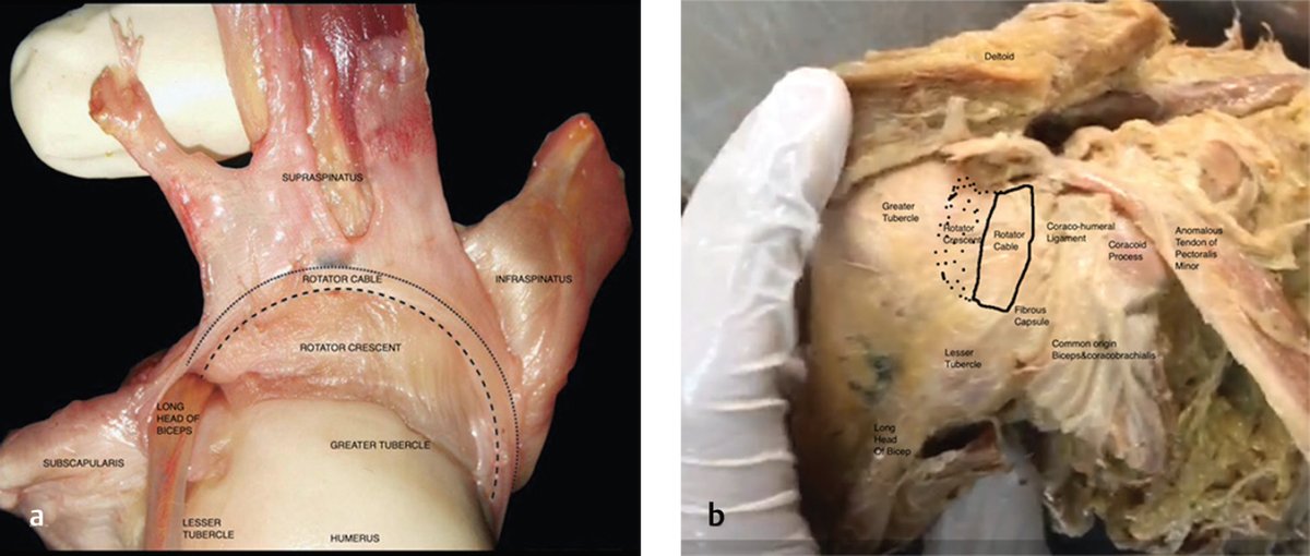 One look at the anatomy of the rotator cuff complex and it's immediately apparent why you cannot isolate a specific muscle with a "special test". thieme-connect.com/products/ejour…