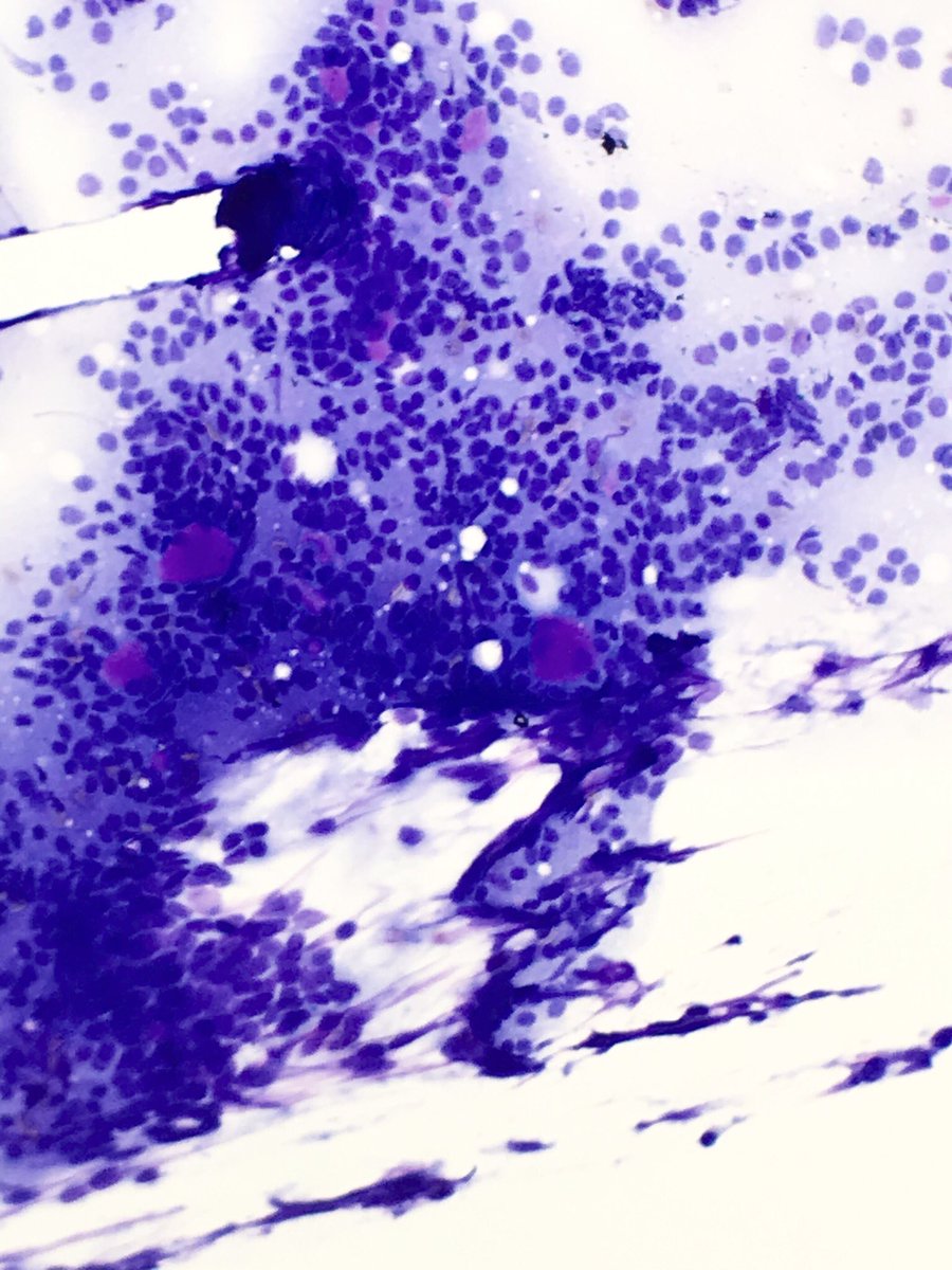 HajaratTara's tweet photo. I mean, isn’t this just beautiful? #cytopathology https://t.co/KjAPcqSuBK