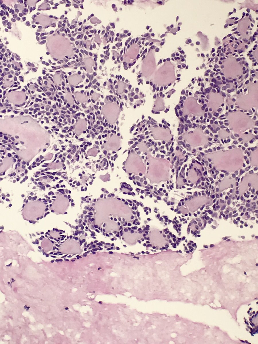 HajaratTara's tweet photo. I mean, isn’t this just beautiful? #cytopathology https://t.co/KjAPcqSuBK
