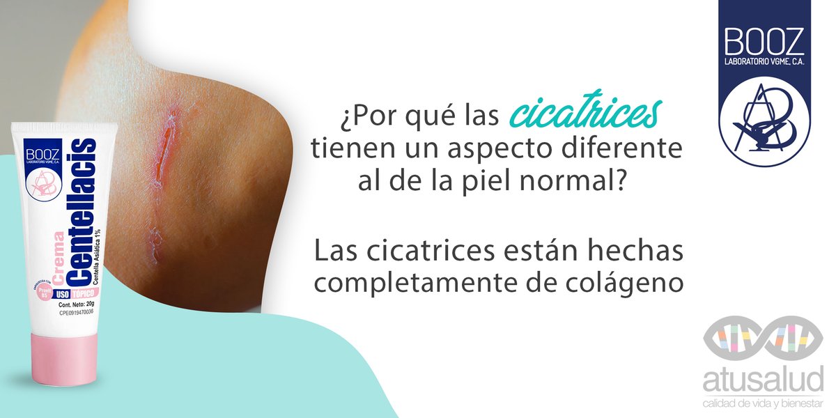 atusaludenlinea's tweet photo. Carecen de elastina por eso, son más duras y menos flexibles que la piel que las rodea. → @booz_lab  #Centellacis #BoozLab #ProductosDeCalidad #Hidramer https://t.co/IICKowRs1F