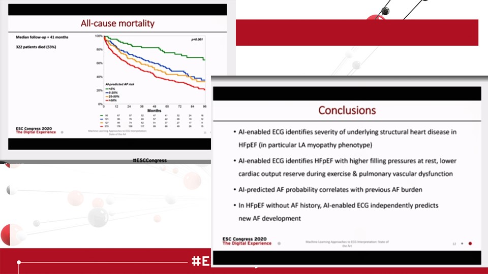 No 9- the penultimate one!  #ESCCongress This is not everyone's cup of tea- but it is an amazing piece! AI analysed HFpEF ECG in SR could "predict" future AF. This is amazing as  #preventive measures can be instigated and timely anticoagulation. I think the future is bright!