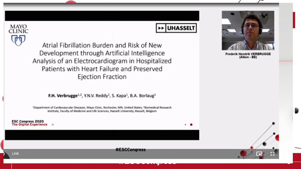 No 9- the penultimate one!  #ESCCongress This is not everyone's cup of tea- but it is an amazing piece! AI analysed HFpEF ECG in SR could "predict" future AF. This is amazing as  #preventive measures can be instigated and timely anticoagulation. I think the future is bright!