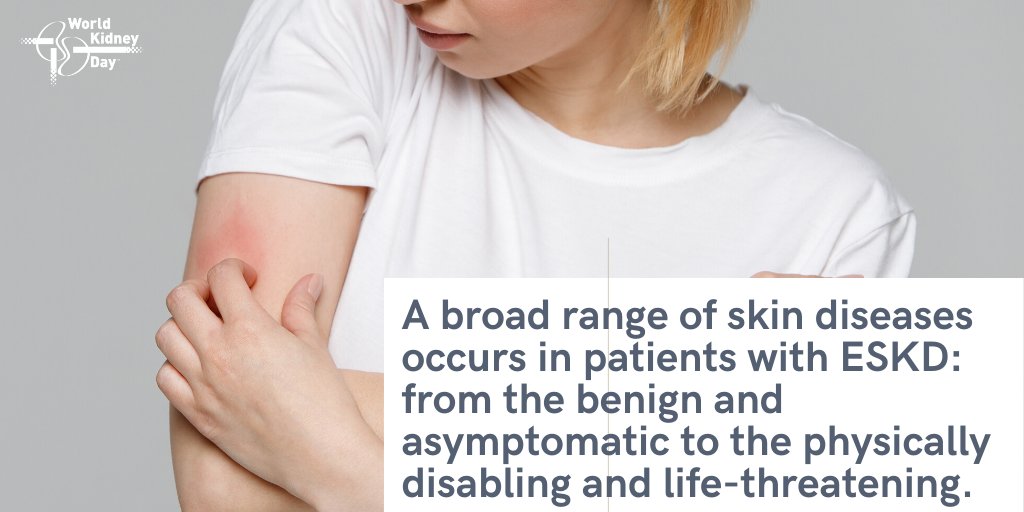 worldkidneyday's tweet image. Many of these #skin diseases negatively impact on quality of life. Their early recognition and treatment are essential in reducing morbidity and mortality. #worldkidneyday