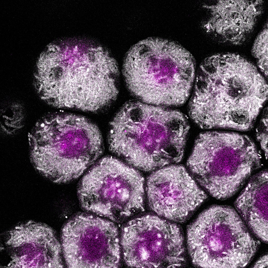 Moreover, rather than simultaneously specifying  #germcells and  #embryonicposterior, the 4 zones of germline genes have distinct functions and a division of labor between them! Zone 1a and b regulate the localization of  #Blochmannia into  #Bacteriocytes. 7/n