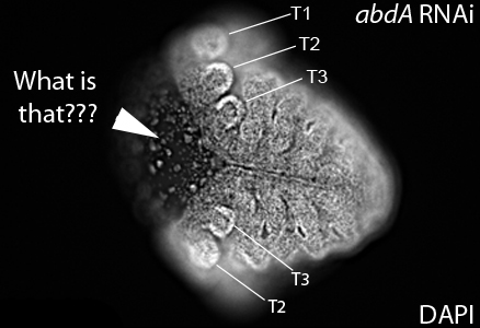 In addition to the truncation phenotype, RNAi of  #abdA and  #Ubx affected the products of the 4 zones that underlie the  #radicalalterations including the complete loss or mislocalization of the  #Bacteriome. But nothing is more striking than the  #zipper phenotype observed. 11/n