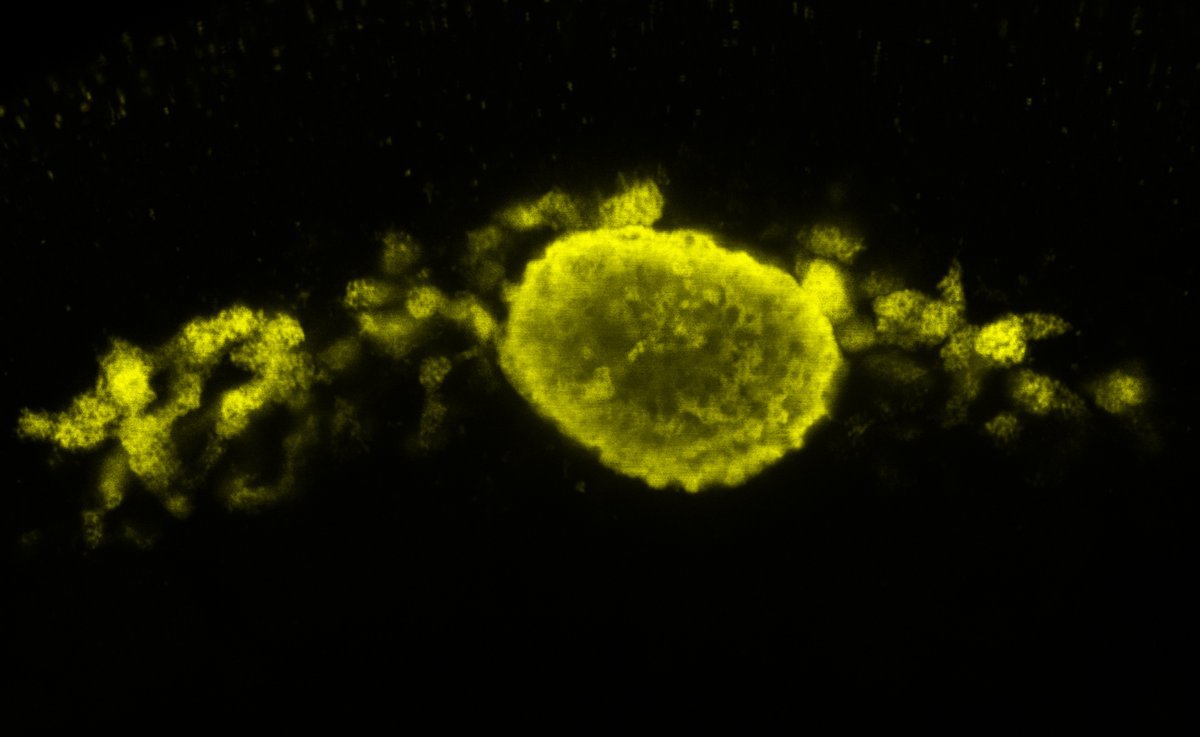 At the  #origin of obligate symbiosis between Blochmannia and Camponotini  #Hox genes evolve in  #germline  #Zone1  #Zone4. Zone 1 patterns Bacteriocytes and Zone 4 guides Bacteriocytes form the  #Bacteriome. Therefore  #MaternalHox was essential for  #developmental  #integration. 20/n