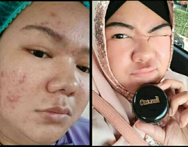 Onazwa Skincare (@OnazwaS) / Twitter