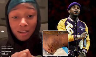 Meg stays rather quiet on the issue probably for Legal reasons. But needless to say... everyone is speculating. It is later revealed that singer Tory Lanez was the one who shot megan in her foot despite denying he ever did.
