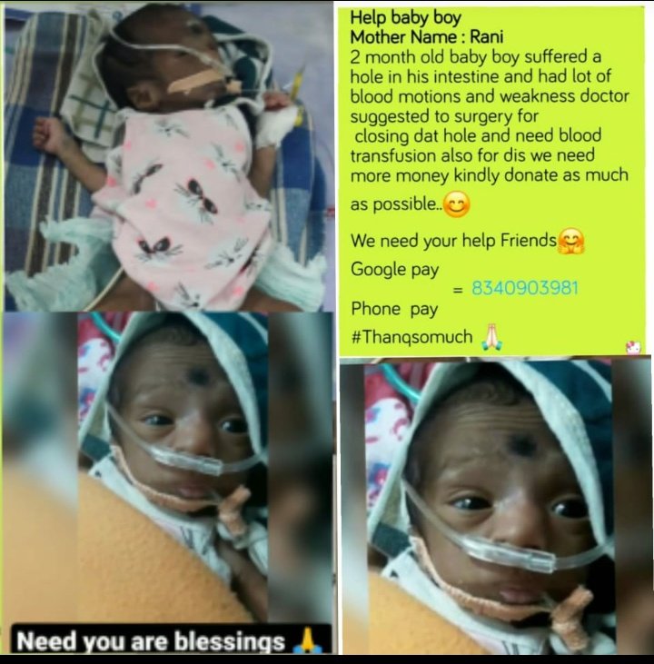 sarathsushanth's tweet photo. Two months old baby anta intestine lo hole undhi anta 
Konchem critical anta 
So meeku thochindhi help cheyandi 
Share kuda cheyandi 
Ninna trend lo post vesinapudu msg chesaru
mathrudevobava charitable trust anta 

Google pay
Phone pay 8340903981 https://t.co/8aTwCZ4RJ3