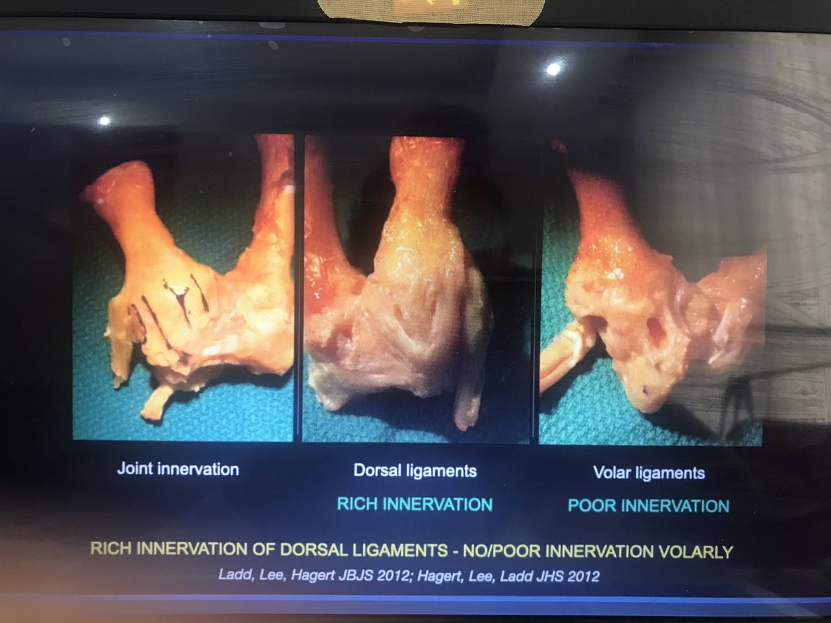 sumeyyecildan's tweet photo. #FESSH2020 #EFSHT2020 #virtualcongress #handtherapy @Orfit https://t.co/PRBT1Fe1cF