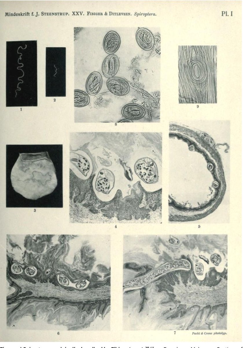 Johannes Fibiger (médico) recibió el premio Nobel en 1926 por el supuesto descubrimiento de un parásito que causaba tumores cancerígenos en el estómago. A su muerte se descubrió que los tumores los causaba deficiencia de vitamina A y ni siquiera eran cancerígenos.