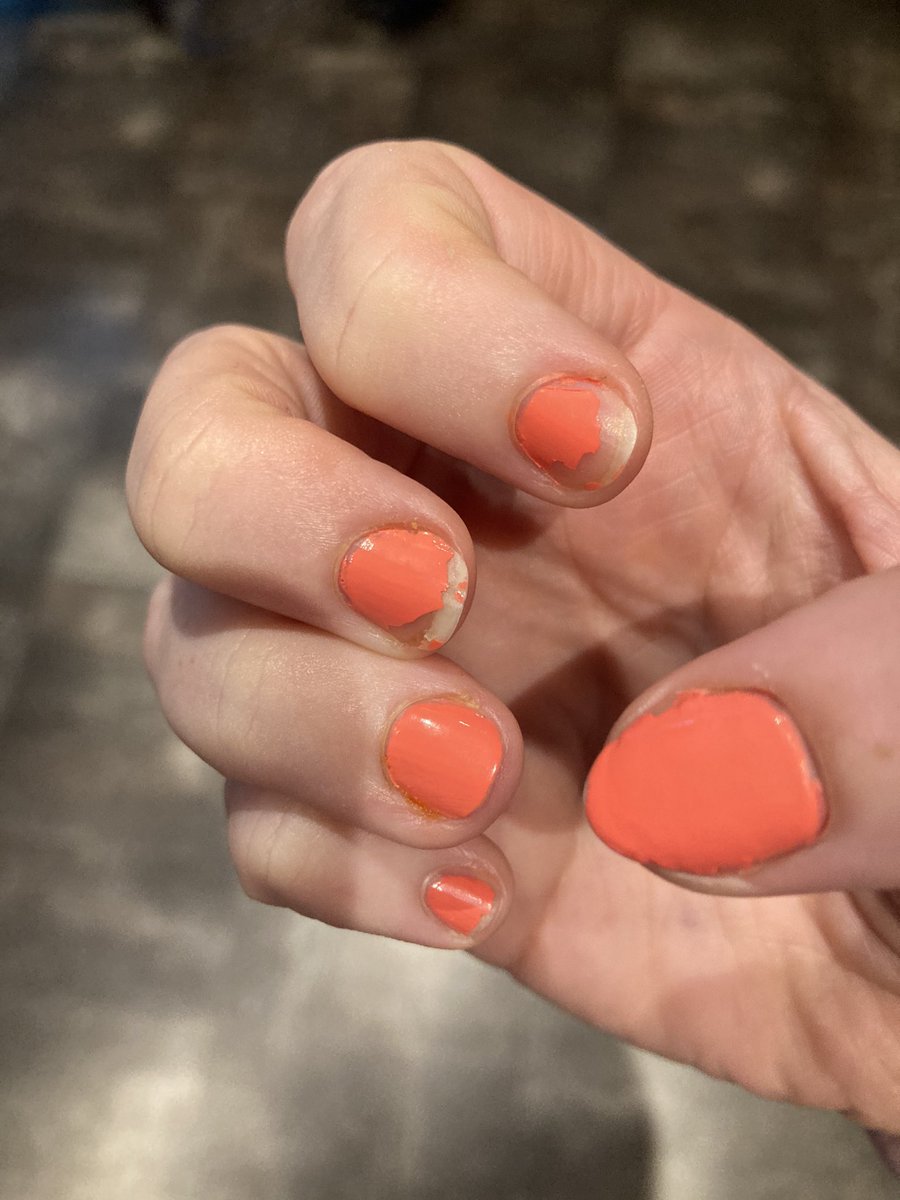 MissSQuinn's tweet photo. Today must have been harder than I realised #chippednails https://t.co/MUH2retd6i