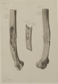 Spigelman and colleagues imaged the calvaria. Below right is a figure from their paper, as well as 1) two sketches of several representative bones drawn by one of Hunter's autopsy assistant, William Bell, and 2) upper right, another SurgiCat photo from RCS./17