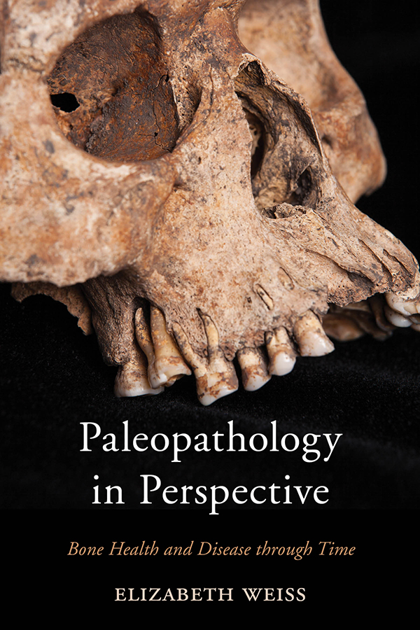 ...but whether these are due to myeloma, metastatic cancer, infection or something else can be difficult to prove. Definitive retrospective diagnosis from ancient bones is tricky. Paleopathology has evolved as a field, but there is still much to learn.  /20End