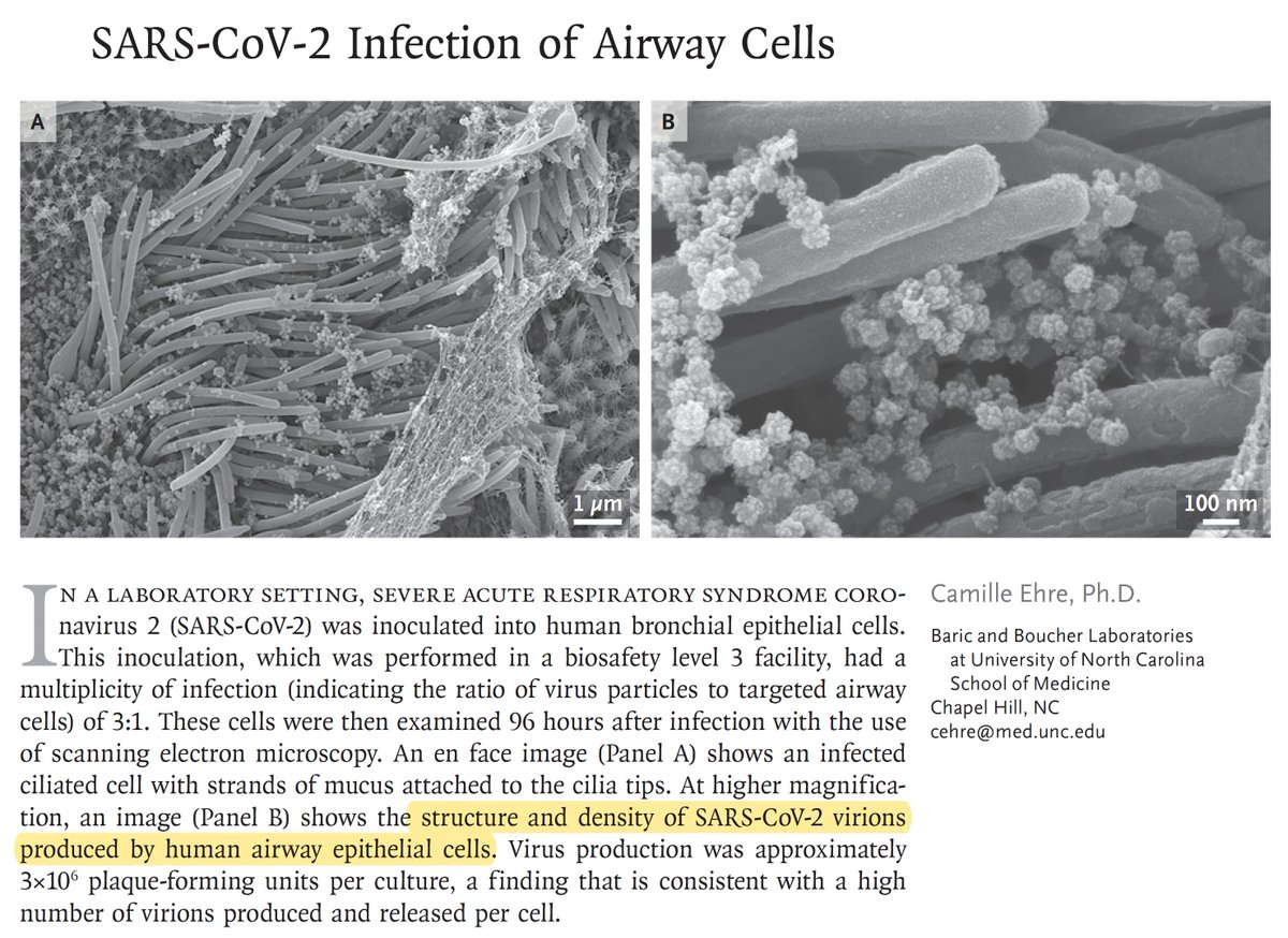 There it is. #SARSCoV2 virions made by a patient's lung cells after it took over
nejm.org/doi/full/10.10…
by <a href="/camilleehre/">Camille Ehre</a> <a href="/NEJM/">NEJM</a>