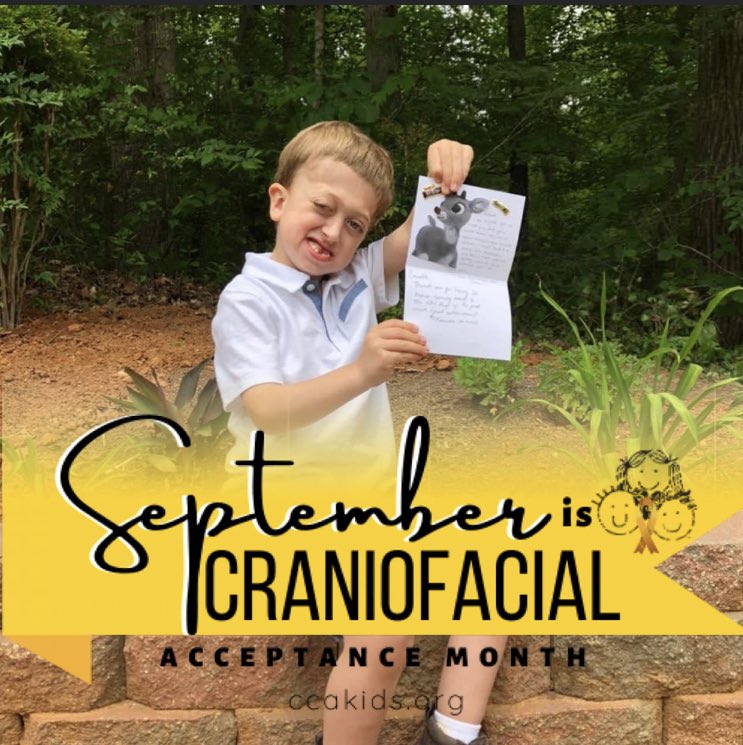 It’s Craniofacial Acceptance Month! This is my Everett showing off his card from the sweet surgery nurses at <a href="/childrensatl/">Children's</a>