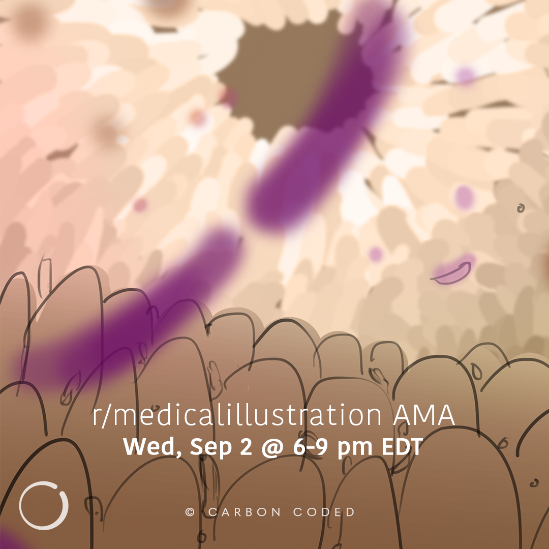 Geoffrey L Cheung (@glcheung) on Twitter photo Hi there! <a href="/rurupoi/">é„@ćć¤ę“»</a> and I are now live to answer your questions about Medical Illustration!
reddit.com/r/medicalillus⦠Hi there! <a href="/rurupoi/">é„@ćć¤ę“»</a> and I are now live to answer your questions about Medical Illustration!
reddit.com/r/medicalillusā¦