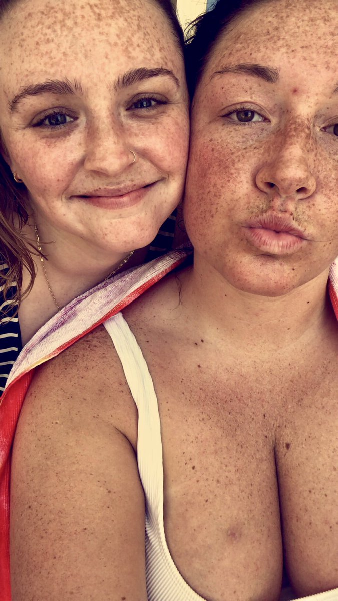 meganbillingsby's tweet photo. Our biggest flex is having natural freckles and not drawing them on w/ makeup @itsannadowning #frecklesforever https://t.co/LfPuZka5v2