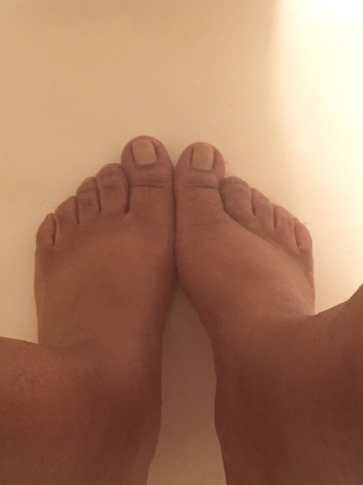 My feet look so short and stubby! https://t.co/HdhEuynf7o<a href="/tag/footfetish"class="tags"><span>#footfetish</span></a><a href="/tag/feet"class="tags"><span>#feet</span></a><a href="/tag/pedicure"class="tags"><span>#pedicure</span></a><a href="/tag/feetpics"class="tags"><span>#feetpics</span></a>