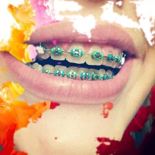 Brackets De Lujo Medellín (brackets_de) Twitter