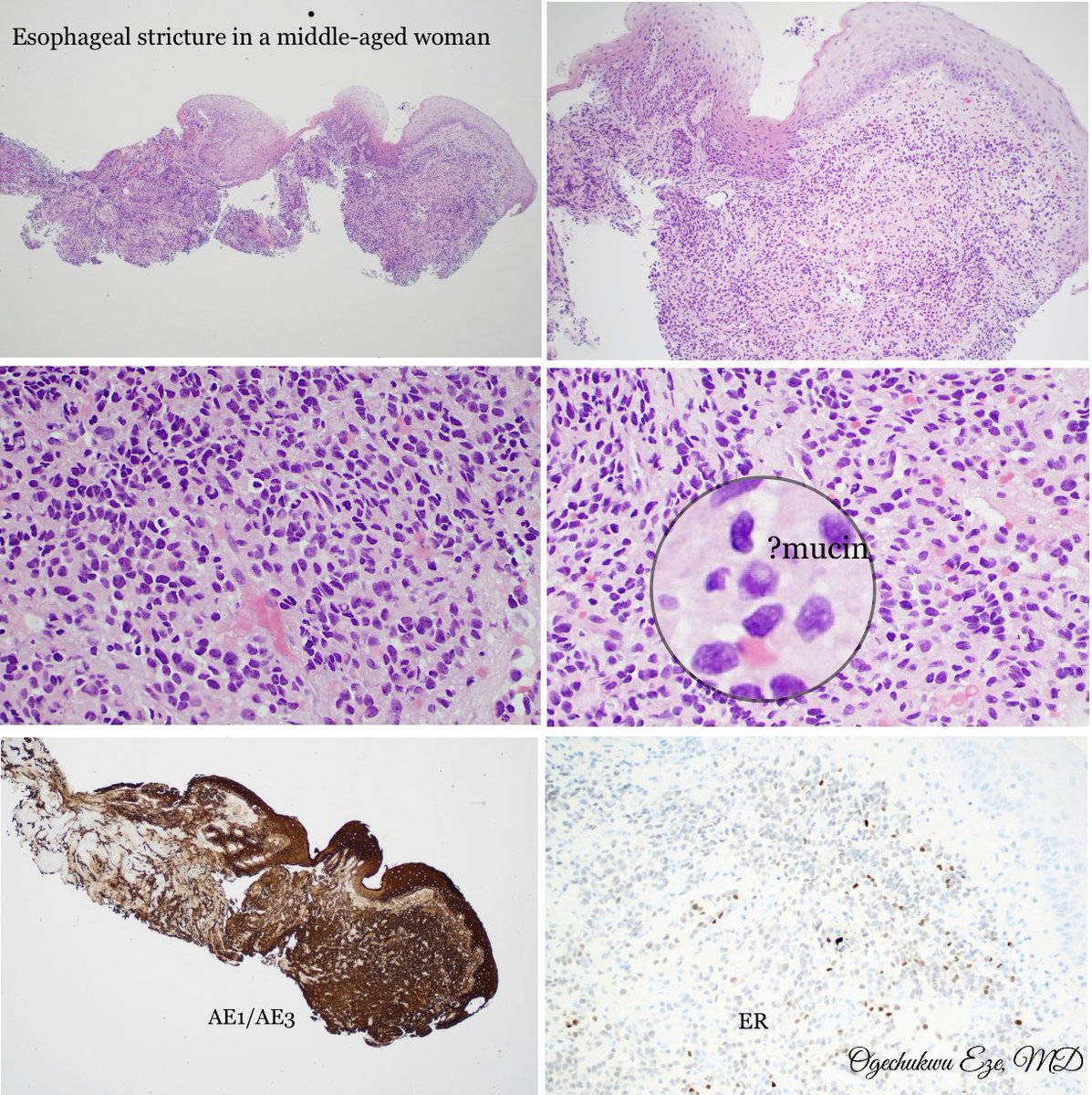 will blood work show heart failure