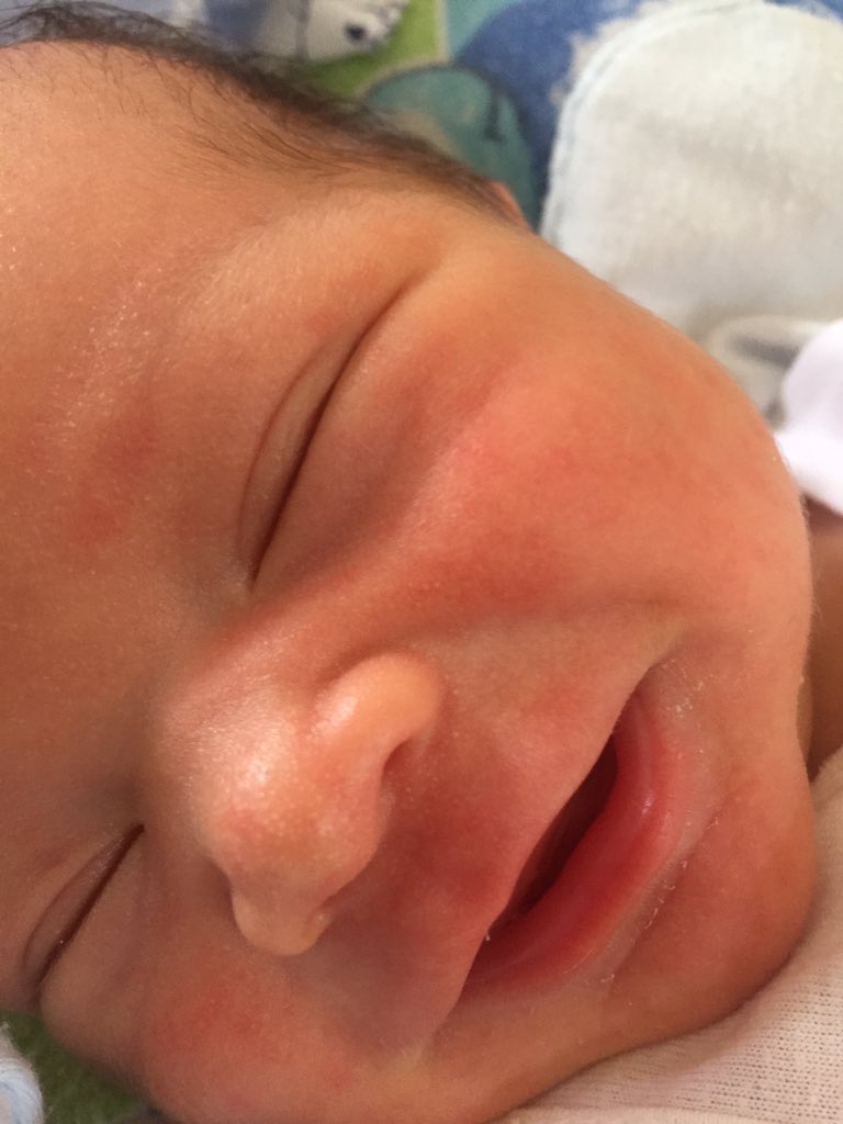 I'm 4 days old today. &amp; its just me &amp; mommy. Looking forward to see my dad soon. Hoping for inbound &amp; outbound travel to be lifted. #LoveIsNotToursim #LoveIsEssential #LiftTheTravelBan #LiftTheBanSweden #LiftThebanPh
