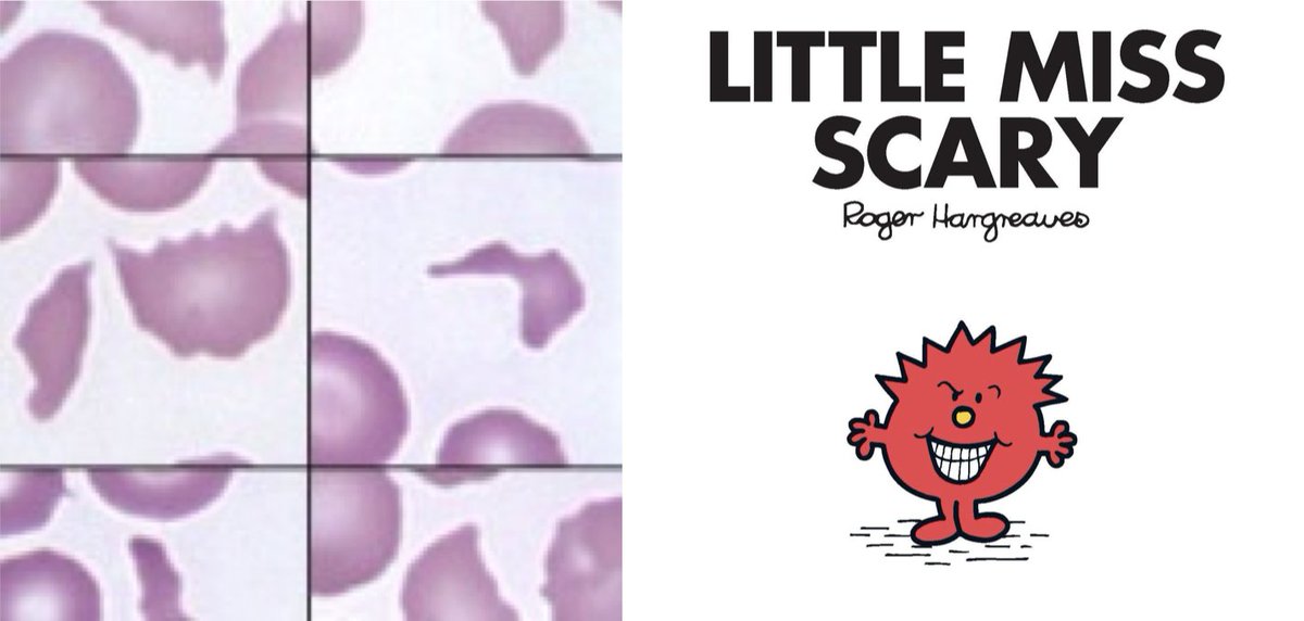 Here we have 'Little Miss Scary' as a schistocyte, striking fear into the hearts of on-call haematology registrars worldwide with her roles in the niche horror genre known only as MAHA.
