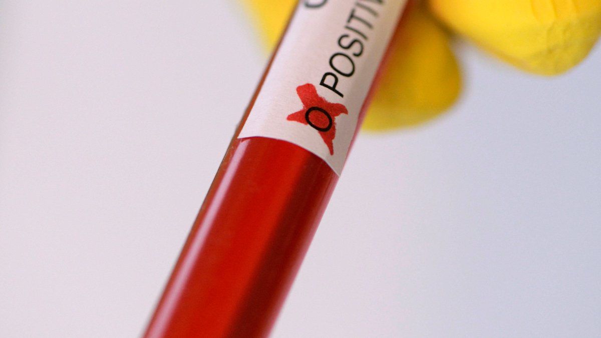 Drosten empfiehlt Ende der Flughafen-Tests. Charité-Chefvirologe Christian #Drosten appelliert an die Politik, die kostenlosen #Corona-Tests an den #Flughäfen einzustellen. Der Grund: Berlins Labore kommen schon jetzt an ihre Grenzen. Zur Langmeldung: checkpoint.tagesspiegel.de/langmeldung/BZ…