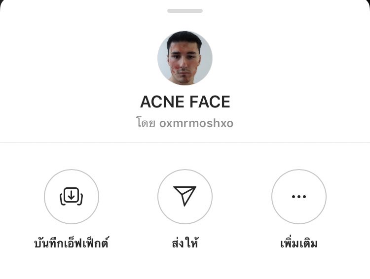 ฝากกดรีพอร์ตฟีลเตอร์เหล่านี้ในไอจีได้มั้ยคะถ้าเห็นว่ามันไม่ควรจะมีอยู่ มีคนเจ็บปวดจากการเป็นสิวอยู่จริง และการที่เอาเรื่อง suffer ของคนอื่นมาเมคฟันมันสมควรแล้วหรอ ฝากดูทีค่ะ
