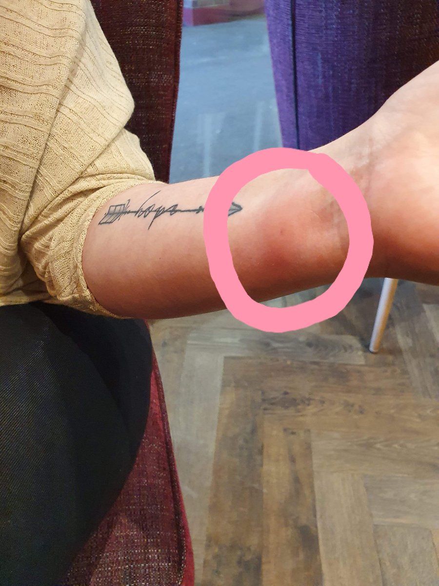 First time in years iv been stung by a wasp , forgot how much they hurt 😢😖